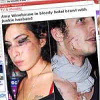 Amy Winehouse – Blutige Prügelei mit Ehemann